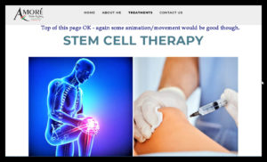Stem Cell Therapy for joint repair and healing.